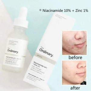 The Ordinary Niacinamide 10% + Zinc 1 % (30ml ) With Batch Code